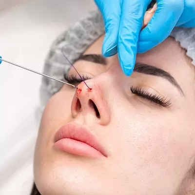 جراحة تجميل الأنف في الرياض