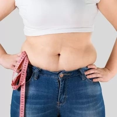 تحويل تجاوز المعدة في الرياض والسعودية وجدة سعر التكلفة