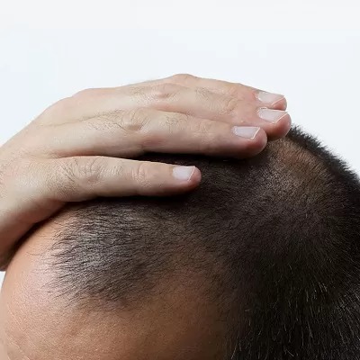 ترميم الشعر في الرياض والسعودية وجدة سعر التكلفة