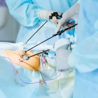جراحة المناظير في الرياض والسعودية وجدة يكلف