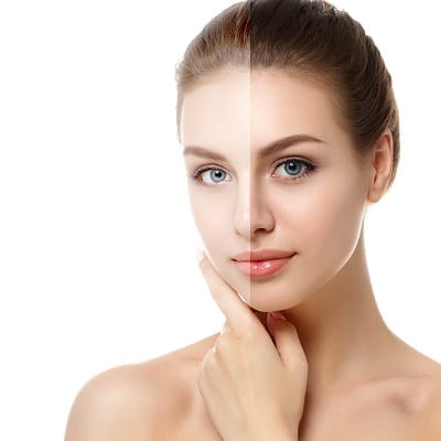 سعر حقن الجلوتاثيون في الرياض