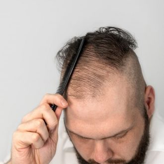 علاجات تساقط الشعر في الرياض والسعودية وجدة | يكلف