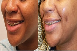 أفضل عيادةخلق الدمل في الرياض