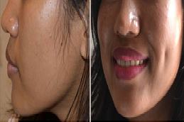 خلق الدمل الرياض