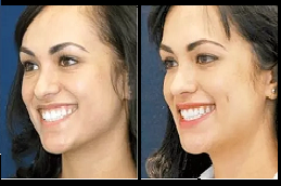 خلق الدمل في الرياض