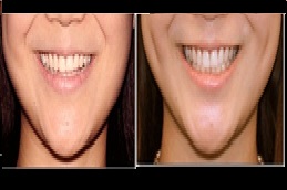 عيادةخلق الدمل في الرياض