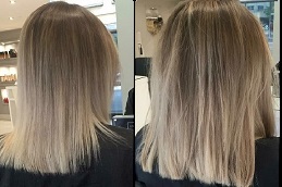 فيلر الشعر في الرياض