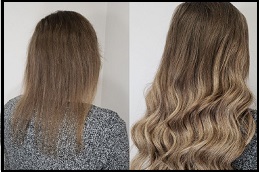 فيلر الشعرالرياض