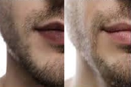 أفضل علاج شفاه المدخن الرياض