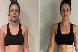 تكلفة العلاج بالاهتزاز برويليكس في الرياض