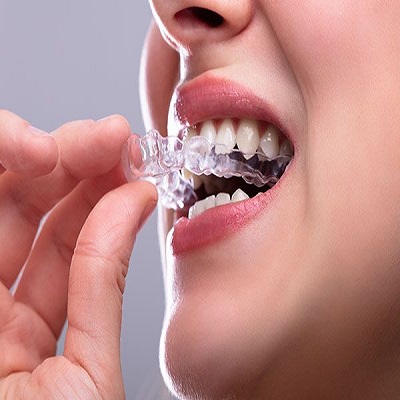 جبيرة الحرس الليلي في الرياض والسعودية وجدة يكلف