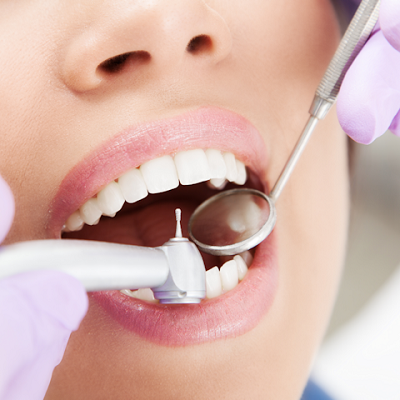 حشو الأسنان في الرياض والسعودية وجدة يكلف