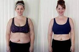 عيادة العلاج بالاهتزاز برويليكس في الرياض