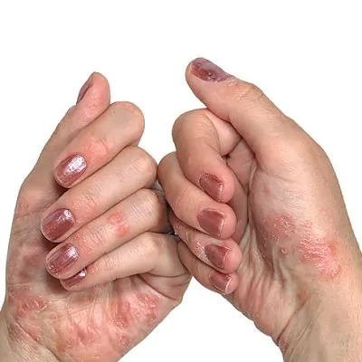 أمراض الجلد في الرياض