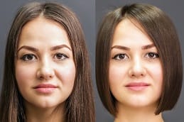 الميزوثيرابي في الرياض