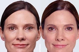 افضل دكتور جلدية بالرياض للتصبغات