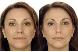 افضل دكتور جلدية بالرياض للحساسيه