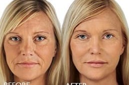 حشوات الجلدية الرياض