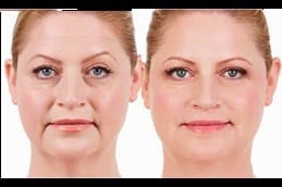 حشوات الجلدية في الرياض