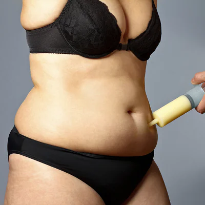 تجربتي مع عملية شفط الدهون في الرياض