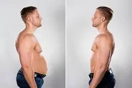 صور قبل وبعد حقن إنقاص الوزن