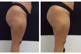 نتائج المؤخرة الفرنسية