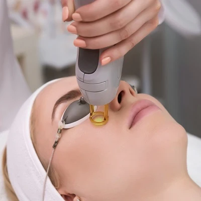 علاج فراكشنال ليزر في الرياض