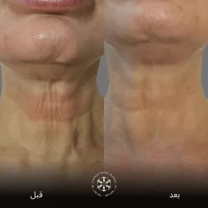 نتائج فينوس ليجاسي