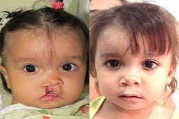 Congenital Anomalies Riyadh