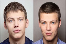 Ear Reshaping Clinic in Riyadh