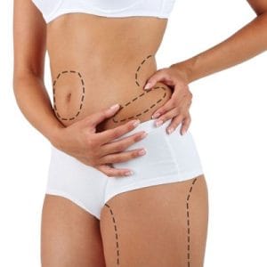 Laser Liposuction Cost In Riyadh