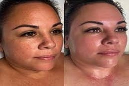 Best DMK Enzyme Therapy Riyadh