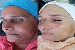 Best DMK Enzyme Therapy in Riyadh