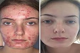 DMK Enzyme Therapy Clinic in Riyadh