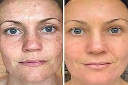 DMK Enzyme Therapy Cost In Riyadh