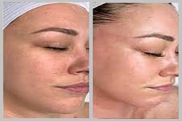 DMK Enzyme Therapy Riyadh