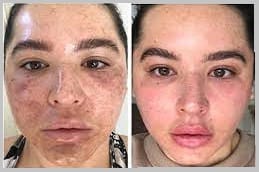 DMK Enzyme Therapy in Riyadh