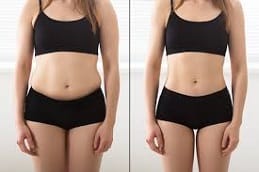 Laser Lipolysis Treatment Riyadh