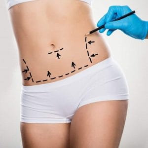 Tummy Tuck Cost In Riyadh