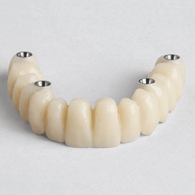 Best Esthetic Bridges in Riyadh, Jeddah & Saudi Arabia Bridges Cost