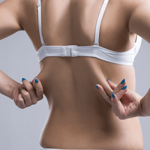 Bra Line Lift Cost in Riyadh