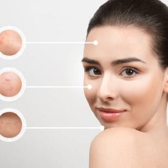 Skin Rejuvenation Treatment Cost in Riyadh