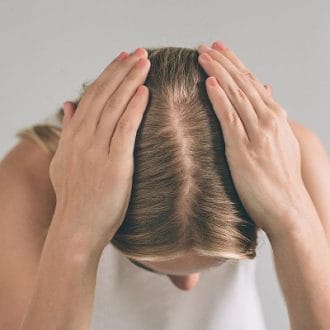 Female Hair Transplant Cost