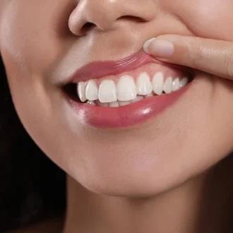 Gingivectomy Cost