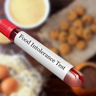 Food Intolerance Test Price