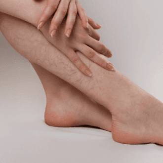 Vascular Surgery Cost in Riyadh