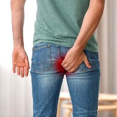 Hemorrhoids By Laser in Riyadh