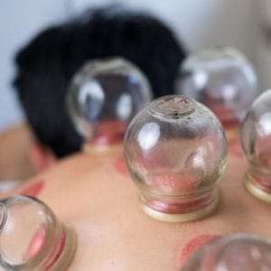 Sunnah Hijama in Riyadh