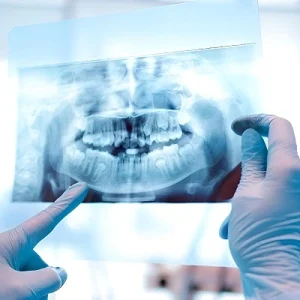 Panoramic And CBCT Teeth X-rays