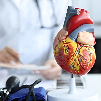 Vascular surgery in Riyadh